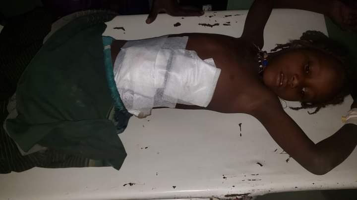 afar_jamal's tweet photo. Where is humanity?
This Non forgotteble habit from Tplf terrorists. 
This is Afar northern children. https://t.co/9iqY9CN7oq