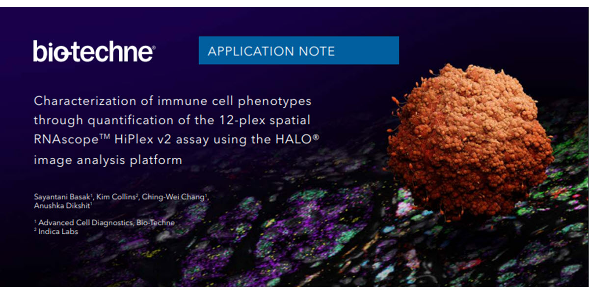 Indica_Labs's tweet photo. Read the latest App Note from ACD Bio and Indica Labs characterizing immune cell phenotypes using the #RNAscope HiPlex v2 assay and #HALOimageanalysis!

https://t.co/LbcS7SXjlm

#acdbio #digitalpathology #biotechne #RNAISH #insituhybridization #fluorescenceinsituhybridization https://t.co/A2iZk0T9nN