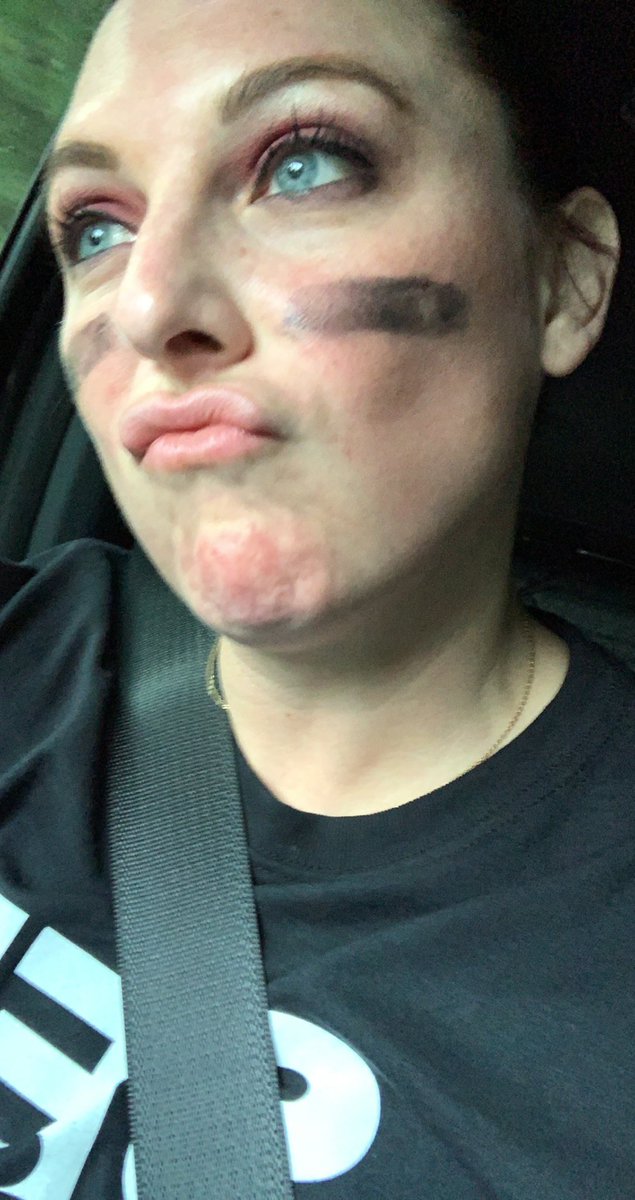 math_msquared's tweet photo. I may not be able to walk tomorrow… but we carry the championship title for the student vs teacher volleyball game…. Jury is out on why I have a huge knot on my forearm 🤷🏻‍♀️😂😬#champion #kmscougarpride #dontmessaround #BeastModeON thank you @KMS_PTA for putting this on! ❤️ https://t.co/vqz3p5Dhy6