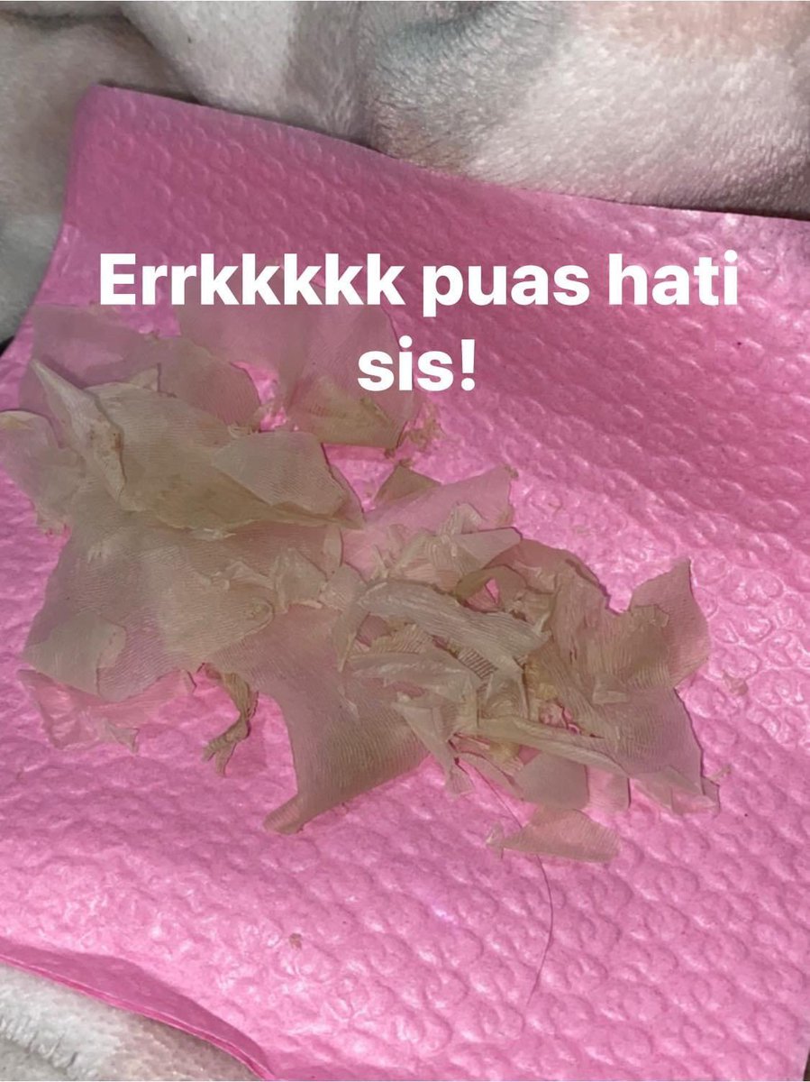 shopeesale's tweet photo. Puas tanggalkan kulit kaki wehh. Lepas dah siap, sapu dgn lotion, pakai stokin &amp; tidur. Esok pagi, 💯 licin macam kaki baby!

Sis beli sini aritu 👇🏼
https://t.co/8xd6GasJIL tak rugi try 🤌🏻 https://t.co/FzOloqdsap