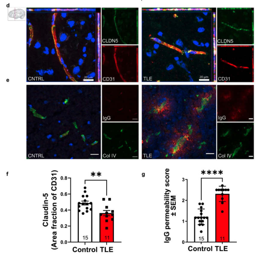 Microvascular stabilization via blood-brain barrier regulation prevents seizure activity | <a href="/NatureComms/">Nature Communications</a>
So much to unpack here 🧐 Check it out for all things #claudin5! #bloodbrainbarrier #Epilepsy
doi.org/10.1038/s41467…