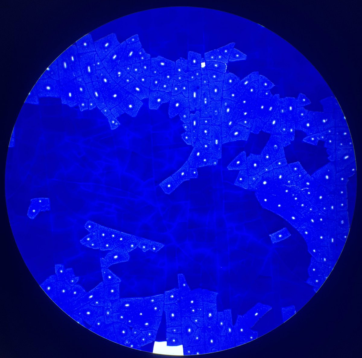 CherchezLaPath's tweet photo. This was a parotid lesion #fna . Non-diagnostic specimen, as you can kind of see it’s predominantly necrotic debris. But I tell you what, felt like I was looking out an airplane window scanning this thing at low power. #PathTwitter #cytology #cytopath https://t.co/wKagOeTK3n
