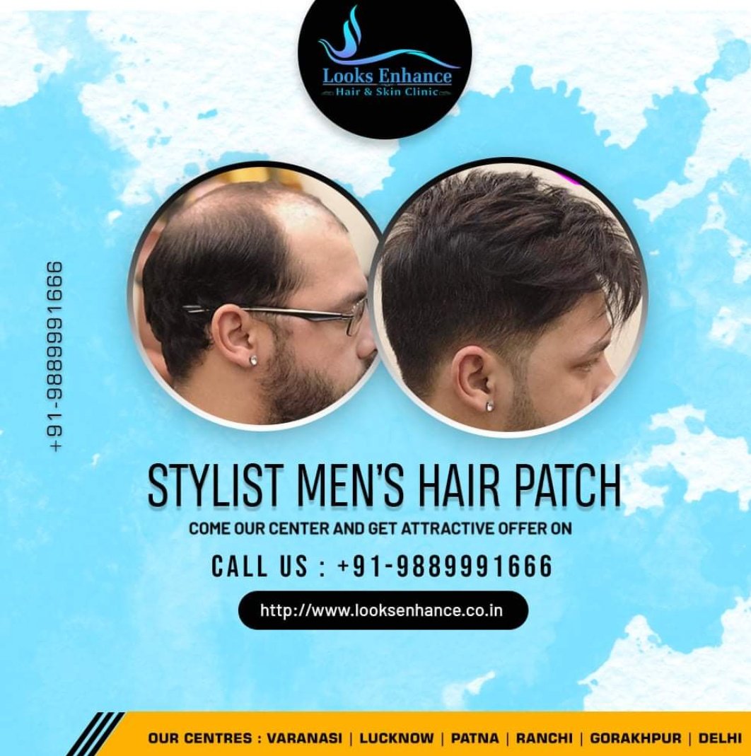 Looks Enhance - Hair Patch + Hair Weaving + Hair Bonding + Hair Wigs + Hair  Transplant in Lucknow - Non Surgical best Hair Bonding clinic in Lucknow,  Hair weaving, hair treatment,