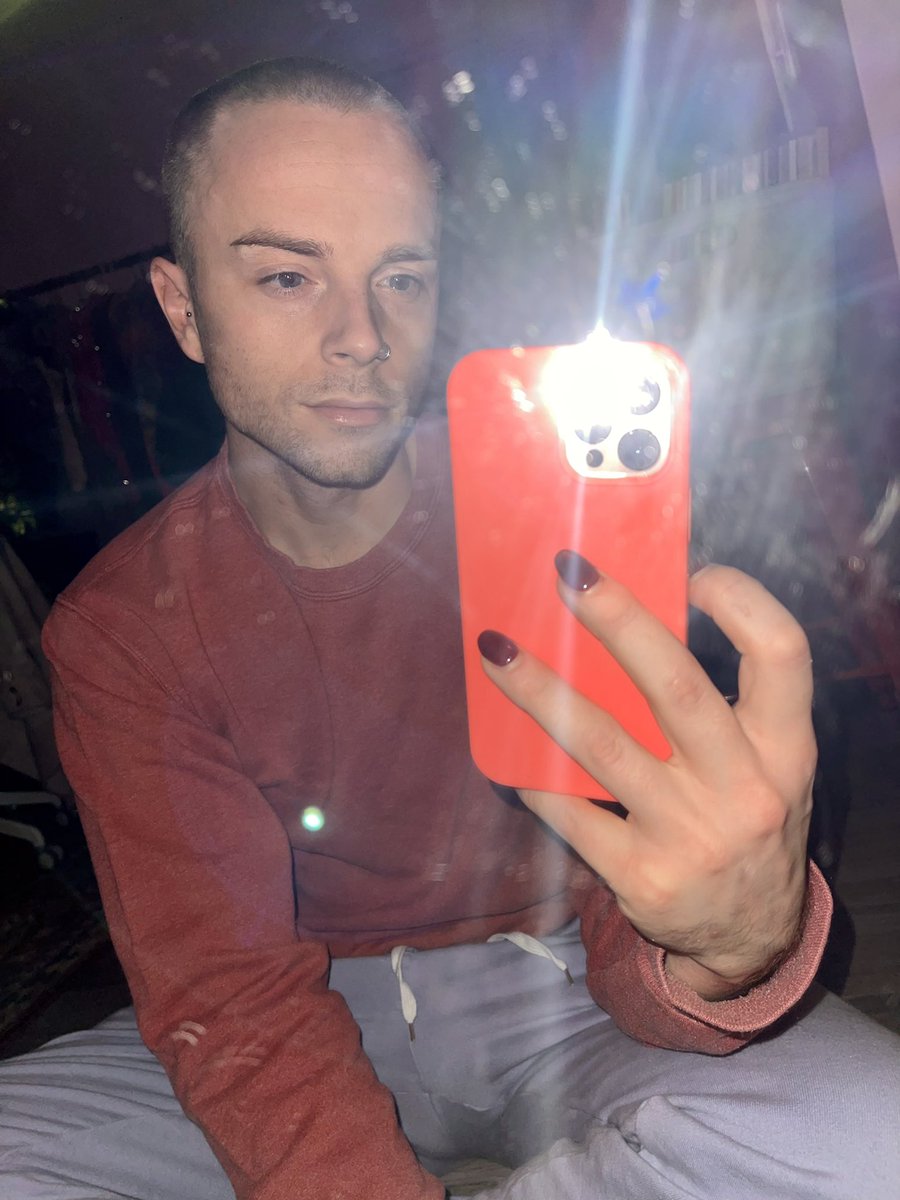 HollandAlex's tweet photo. Who needs hair anyway https://t.co/Vaim6ia2lI