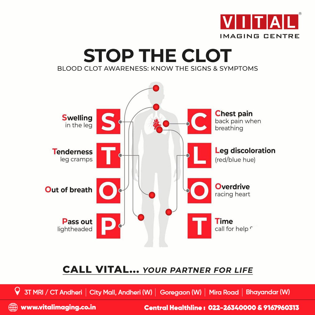 vital_imaging's tweet photo. When the blood clots do not dissolve properly, it can pose a threat to your life. Know your body to stop the clot.

#vital #vitalimaging #ctscan #medicalscan #radiology #sonography #mri #mriscan #xrays #ultrasound #3TMR #bloodclots #symptoms https://t.co/a3aEwZRXd1