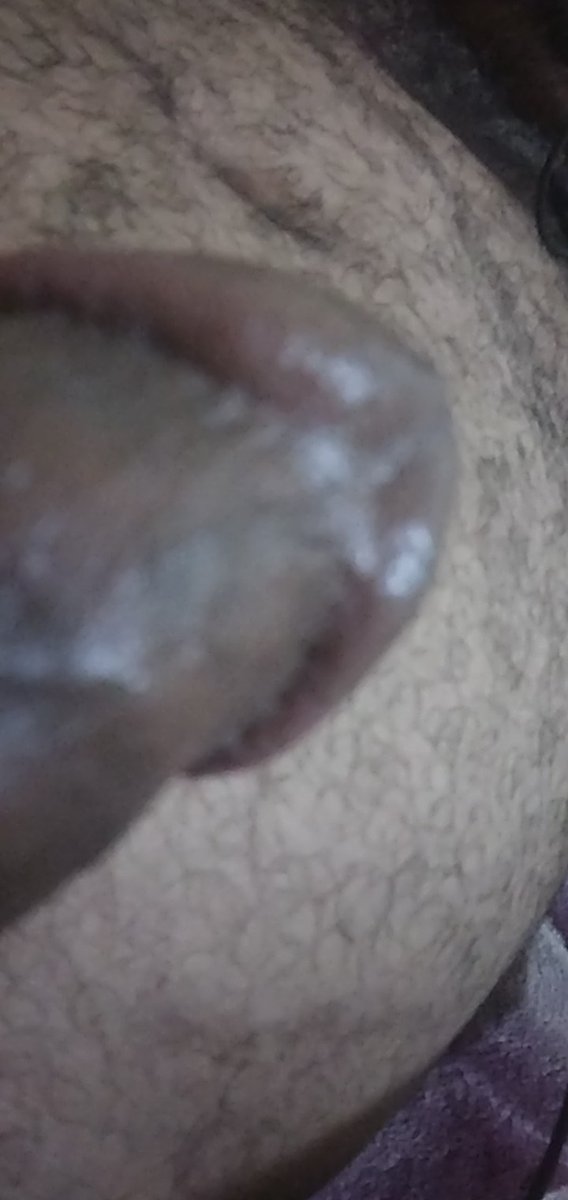 dyFwad2's tweet photo. @x44xxxx هذ العلاج https://t.co/hQnyCTQZBZ