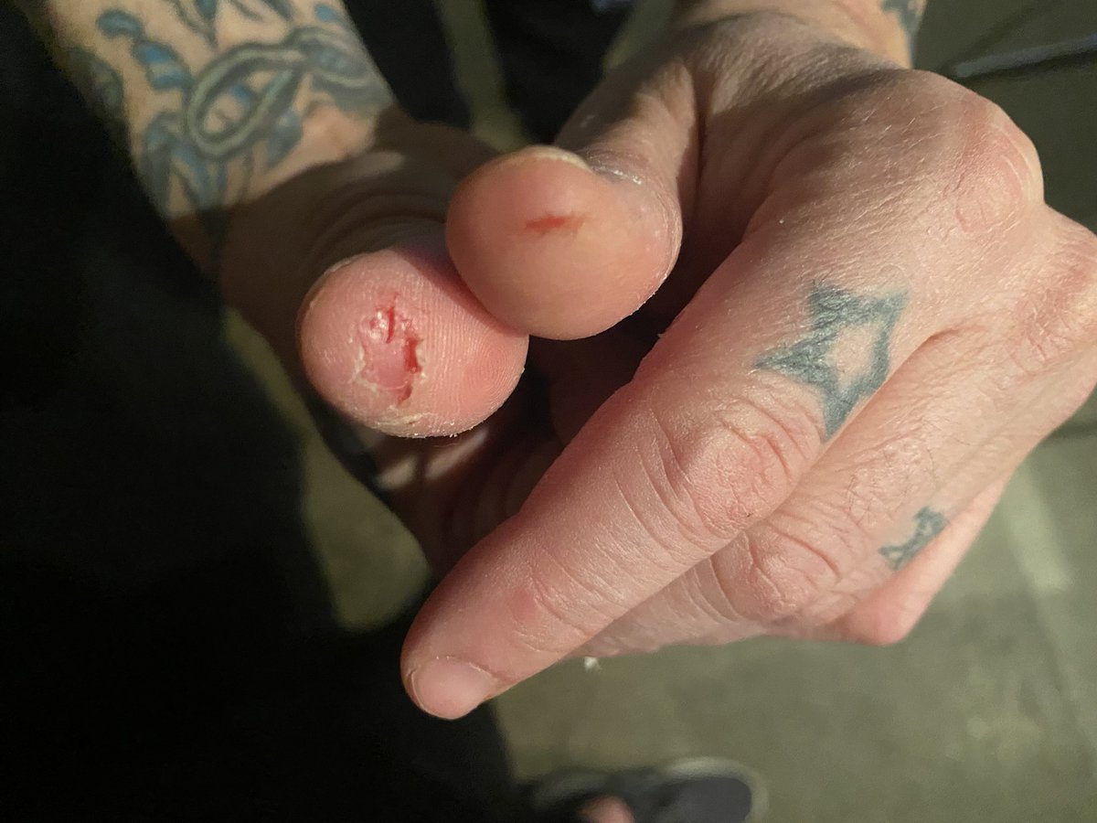 Mike Portnoy 🤘 tweet media