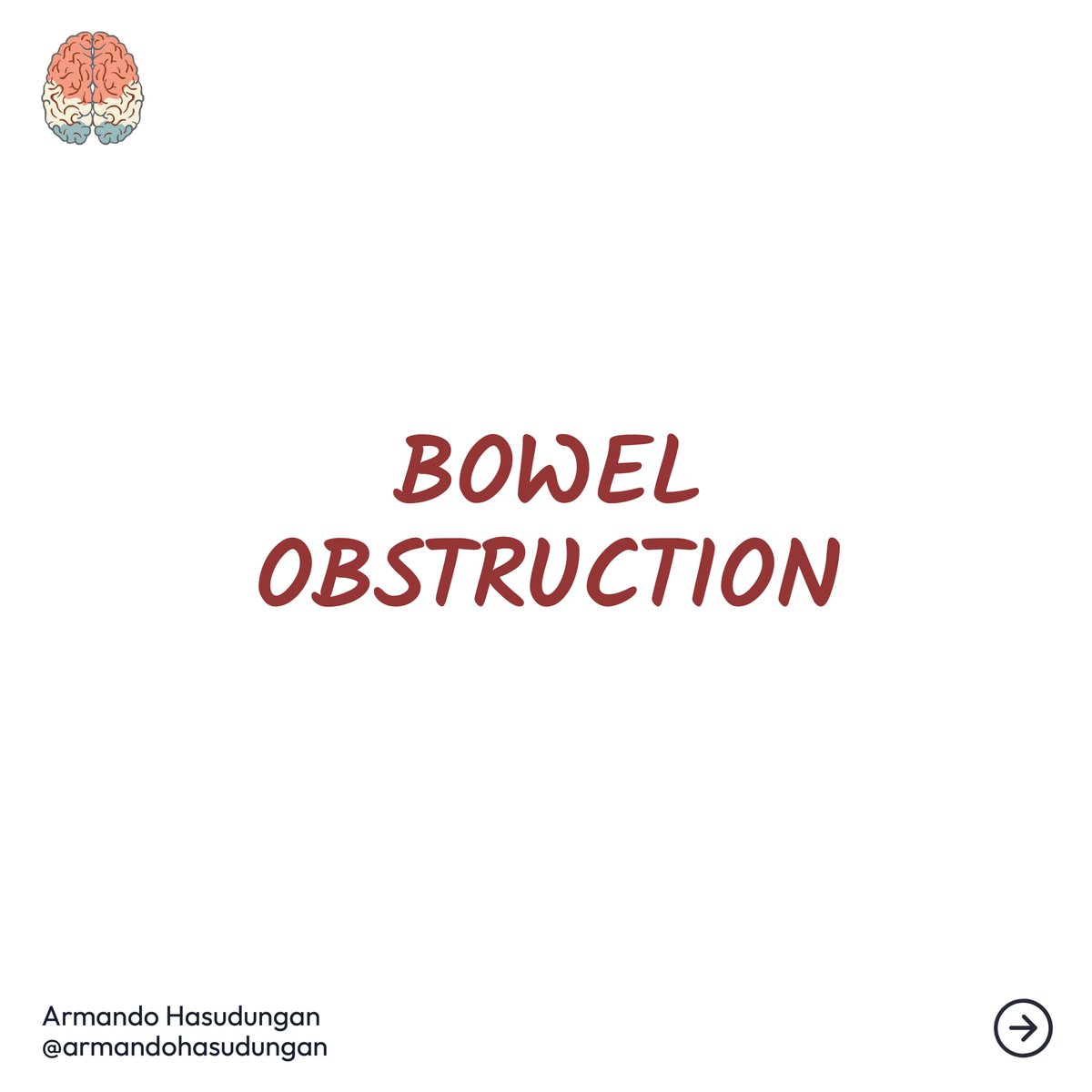 armandohasudung's tweet image. A bowel obstruction is a severe condition that occurs when something blocks your intestines, either large or small intestines.

Full Video
buff.ly/37pkDmc

Detailed Post
buff.ly/34r1Hle

#bowelobstruction #intestinalobstruction #smallintestines #largeintestines