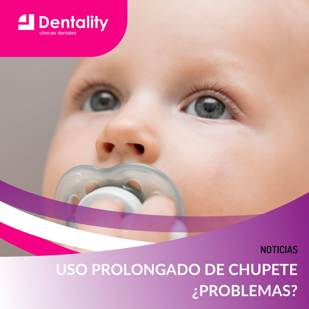 💜  Existe la creencia popular de que el chupete es malo para los dientes. Sin embargo, los odontopediatras coinciden en que solo suele causar problemas bucales cuando se usa de forma prolongada.

👉🏻dentality.es