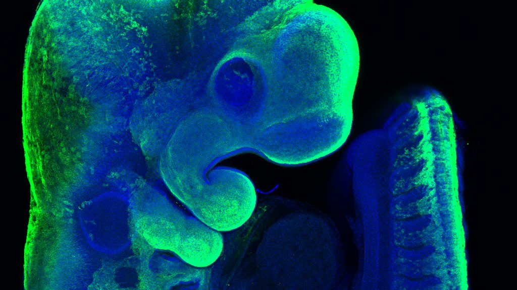 MRC National Mouse Genetics Network (@mrcmousenetwork) on Twitter photo The Congenital Anomalies cluster, led by <a href="/KarenJLiu/">Prof Karen J Liu</a> at <a href="/KingsCollegeLon/">King's College London</a>, aims to make precisely engineered mouse models of gene variants identified in patients to assess how they lead to disease, often through effects on multiple organ systems:
nmgn.mrc.ukri.org/clusters/conge… The Congenital Anomalies cluster, led by <a href="/KarenJLiu/">Prof Karen J Liu</a> at <a href="/KingsCollegeLon/">King's College London</a>, aims to make precisely engineered mouse models of gene variants identified in patients to assess how they lead to disease, often through effects on multiple organ systems:
nmgn.mrc.ukri.org/clusters/conge…