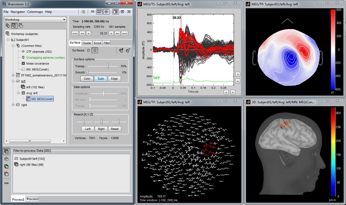nitrc_info's tweet image. Brainstorm is a free, open-source application dedicated to the analysis of brain data Brainstorm features comprehensive user-friendly tools which does not require any programming knowledge @brainstorm2day bit.ly/3uHJwSH #openscience #braindata