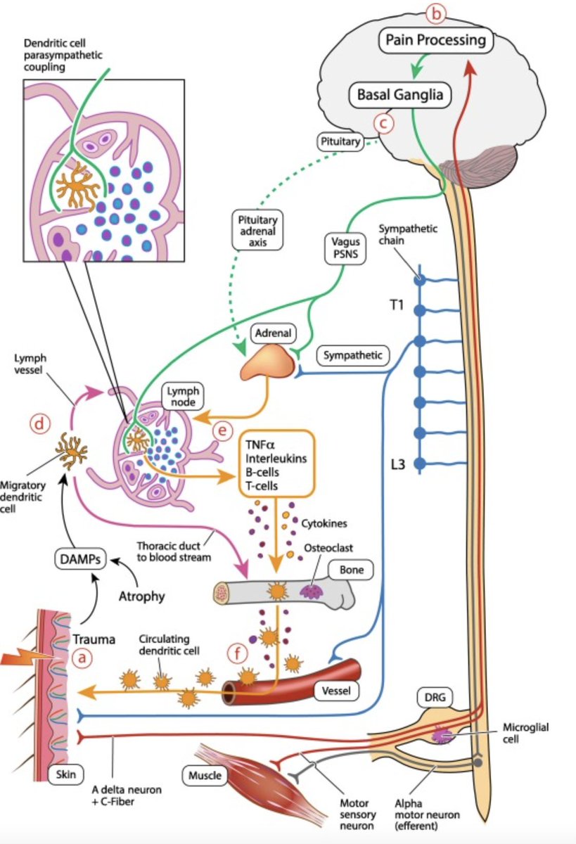 altThinq's tweet photo. This one seems to have flown under the radar, but makes some compelling arguments. Fits very nicely with the previous NEI ensemble supersystem approach. "A new hypothesis for the pathophysiology of complex regional pain syndrome" open access here https://t.co/7Hcabx4fuF https://t.co/PyxhqgGTtn