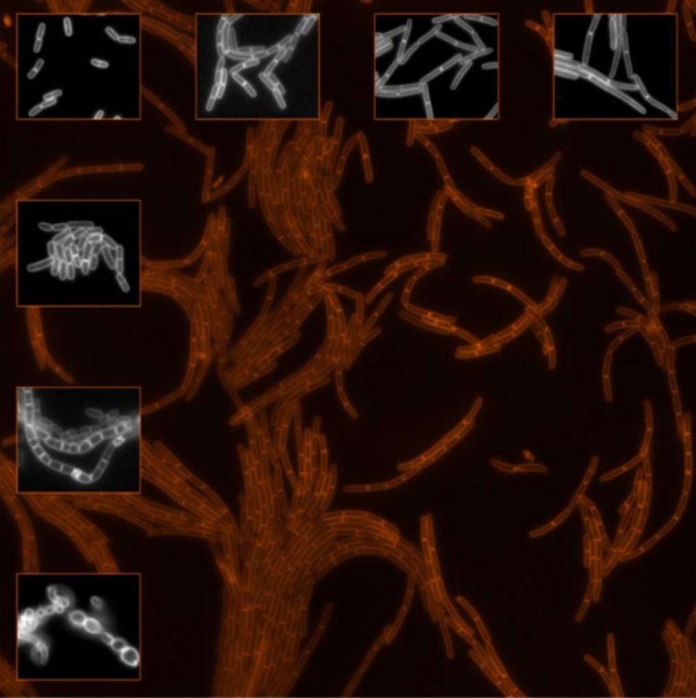 🚨 Our Latest Virtual Issue is now alive! 
<a href="/MolMicroEditors/">Mol Micro Editors</a> @wileymicrobio

Cell Wall Architecture and Function in Microbial Physiology 🦠🔬🧫 is now available on our website! 👇👇👇
onlinelibrary.wiley.com/doi/toc/10.111…