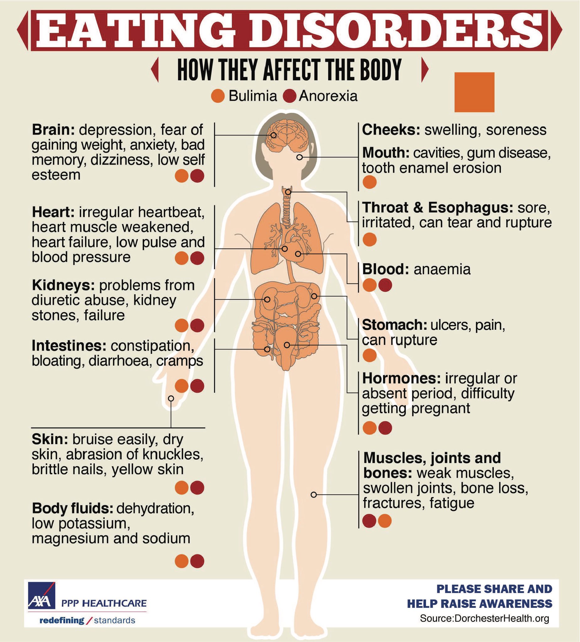 Eating Disorders