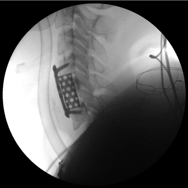 Womcot Spain tweet media