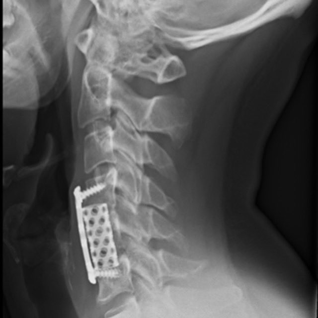 Womcot Spain tweet media