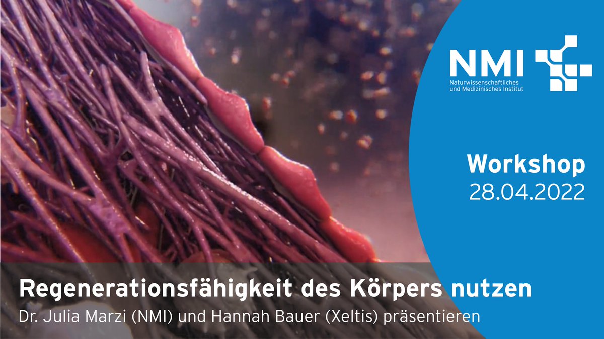 Ist unser Körper verletzt, setzen regenerative Prozesse ein um die Heilung einzuleiten. Welche Rolle bildgebende Methoden in der Forschung dabei spielen, erklären wir -<a href="/NMI_DE/">NMI</a>  und <a href="/Xeltis/">Xeltis</a> - in unserem nächsten kostenlosen Webinar. Infos: bit.ly/37yTuwQ