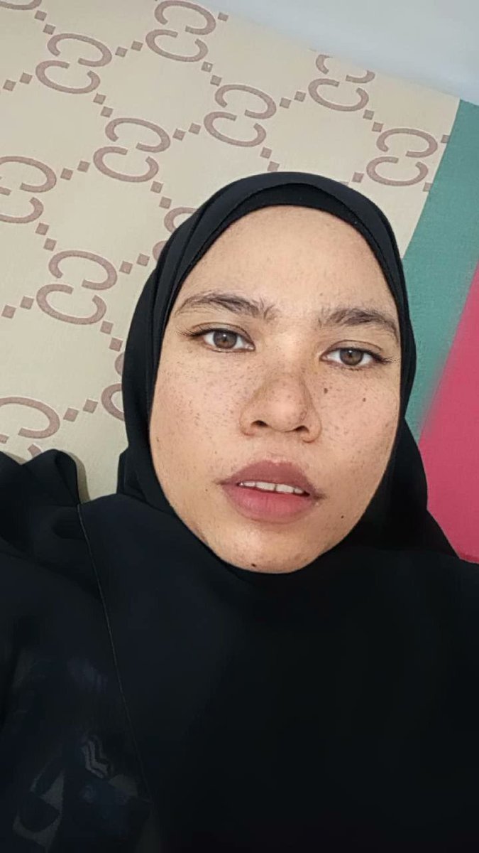 dijalanpulang_'s tweet photo. with freckles on face✨ https://t.co/TQbFqDxYA5
