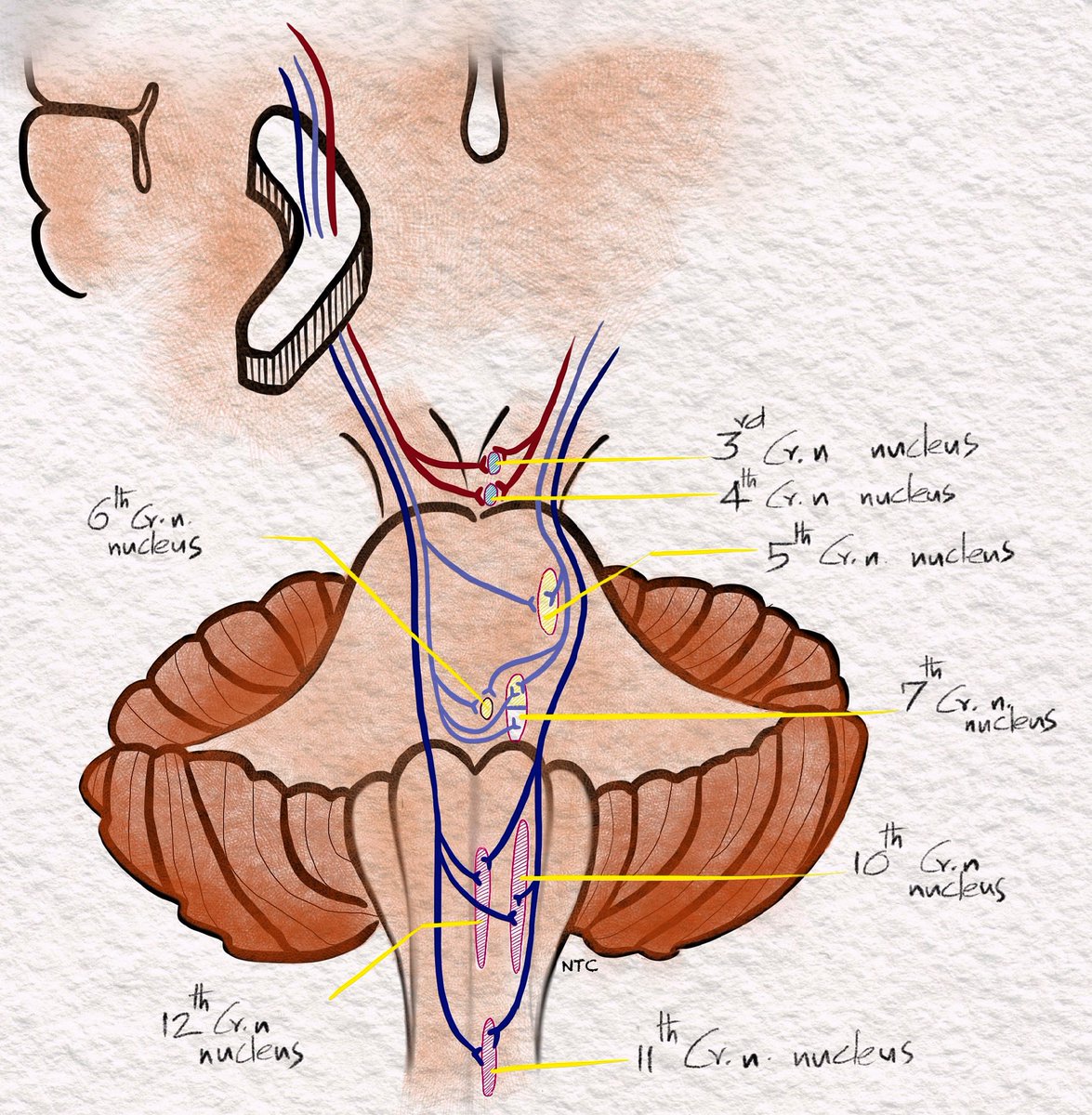 neuroteaching's tweet photo. https://t.co/NBL4f7Rd1C. This podcast episode will be very useful for all medical students.
#MedicalStudent #mbbs #medico #medicalschool #MedEd #MedTwitter #Neurosurgery #NurseTwitter #MedStudentTwitter #nursingstudents #neurotwitter #hemiplegia #neurocase #neuro https://t.co/pL0a2cGQuO