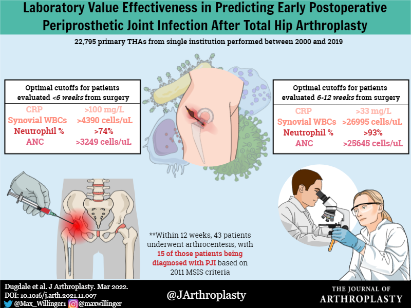 The Journal of Arthroplasty (@jarthroplasty) on Twitter photo Dx #PJI after #THA with high accuracy:
*<6wks: CRP ≥100 mg/L or syn WBCs ≥4390 cells/μL.
*6 -12wks: CRP ≥33 mg/L, syn WBC ≥26,995 cells/μL, and neuts ≥93%.
<a href="/womenAAHKS/">WomenInArthroplasty</a> <a href="/MayoOrthoRes/">Mayo Orthopedic Residency</a> <a href="/orthosmash69/">Orthosmash69</a> <a href="/DrAntoniaChen/">Antonia Chen</a> <a href="/jointdocShields/">John Shields, MD, FAAOS</a> <a href="/kate_wynne/">Dr. Kate Wynne</a>
arthroplastyjournal.org/article/S0883-… Dx #PJI after #THA with high accuracy:
*<6wks: CRP ≥100 mg/L or syn WBCs ≥4390 cells/μL.
*6 -12wks: CRP ≥33 mg/L, syn WBC ≥26,995 cells/μL, and neuts ≥93%.
<a href="/womenAAHKS/">WomenInArthroplasty</a> <a href="/MayoOrthoRes/">Mayo Orthopedic Residency</a> <a href="/orthosmash69/">Orthosmash69</a> <a href="/DrAntoniaChen/">Antonia Chen</a> <a href="/jointdocShields/">John Shields, MD, FAAOS</a> <a href="/kate_wynne/">Dr. Kate Wynne</a>
arthroplastyjournal.org/article/S0883-…