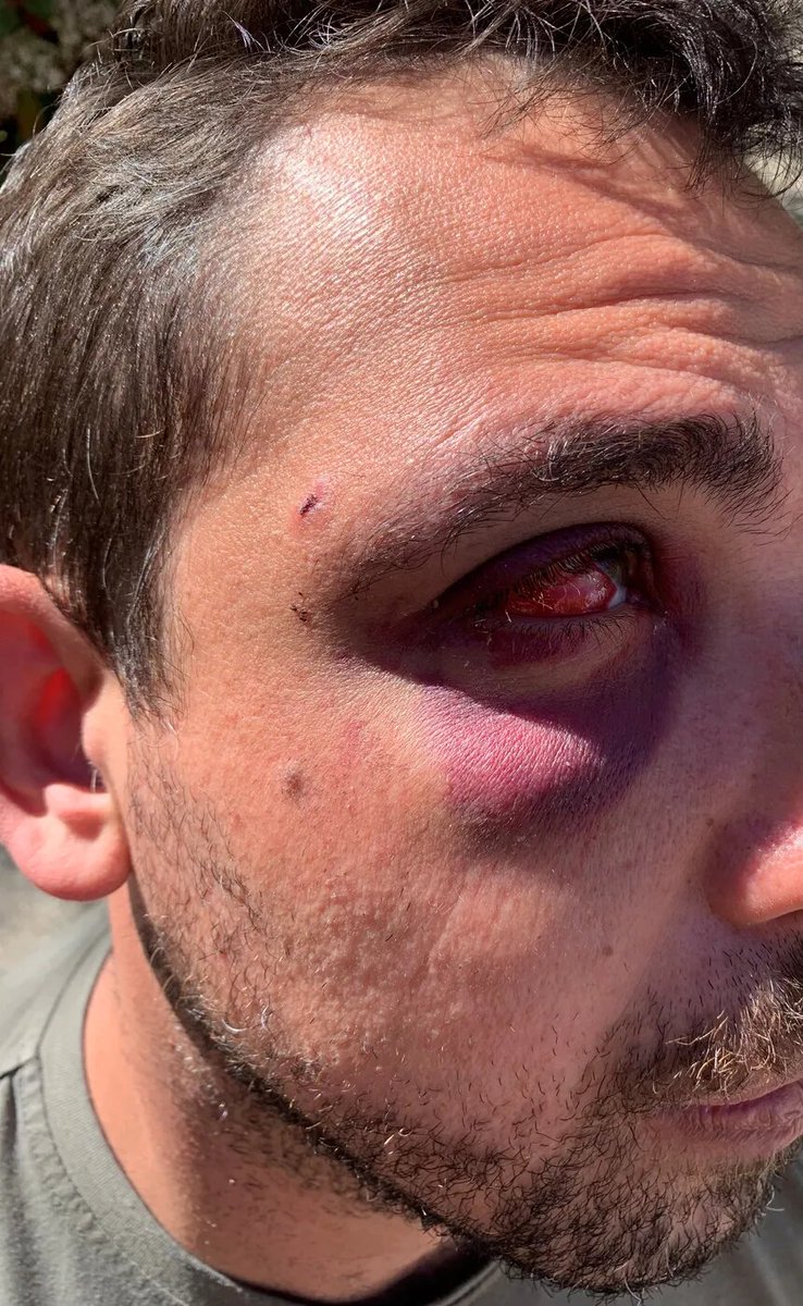 F_Desouche's tweet image. Saint-Pargoire (34) : Deux jeunes restaurateurs agressés par une vingtaine de personnes - fdesouche.com/2022/04/20/deu…