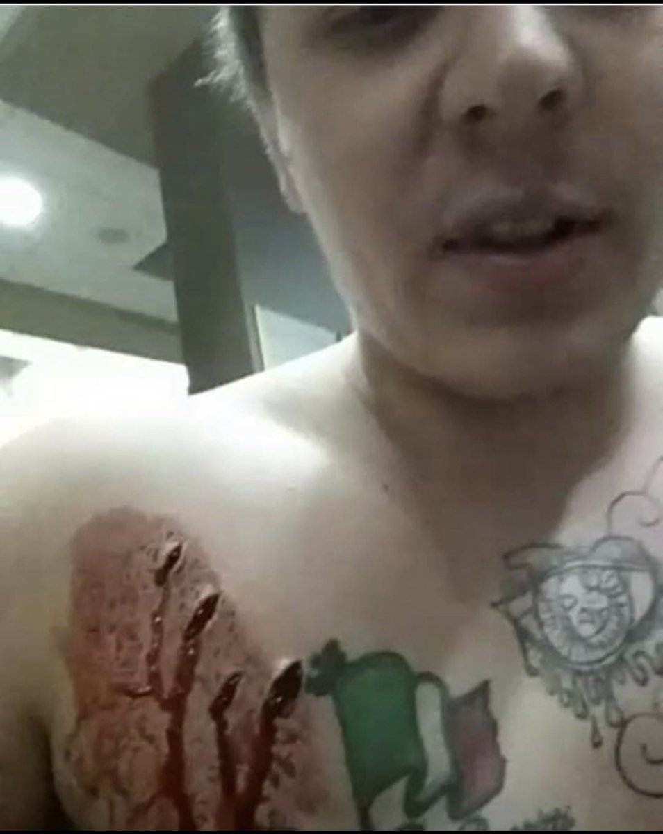 champloosloppy's tweet photo. Getting stabbed was crappy 😅 https://t.co/bgp5k7NSOW