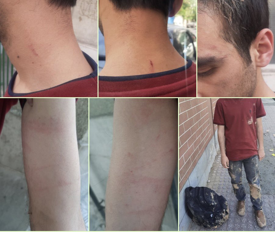 fereshteh_tousi's tweet photo. ۴ نفر از ماموران حراست دانشگاه علم و صنعت، در روز روشن یک دانشجو را حسابی کتک زده‌اند، بعد هم نیروی انتظامی را خبر کرده و دانشجو را به کلانتری منتقل کرده‌اند!
به دلیل پخش بیانیه‌ای از طرف انجمن آرمان که به همین رفتارها اعتراض داشته. https://t.co/NmVnAcXvGs