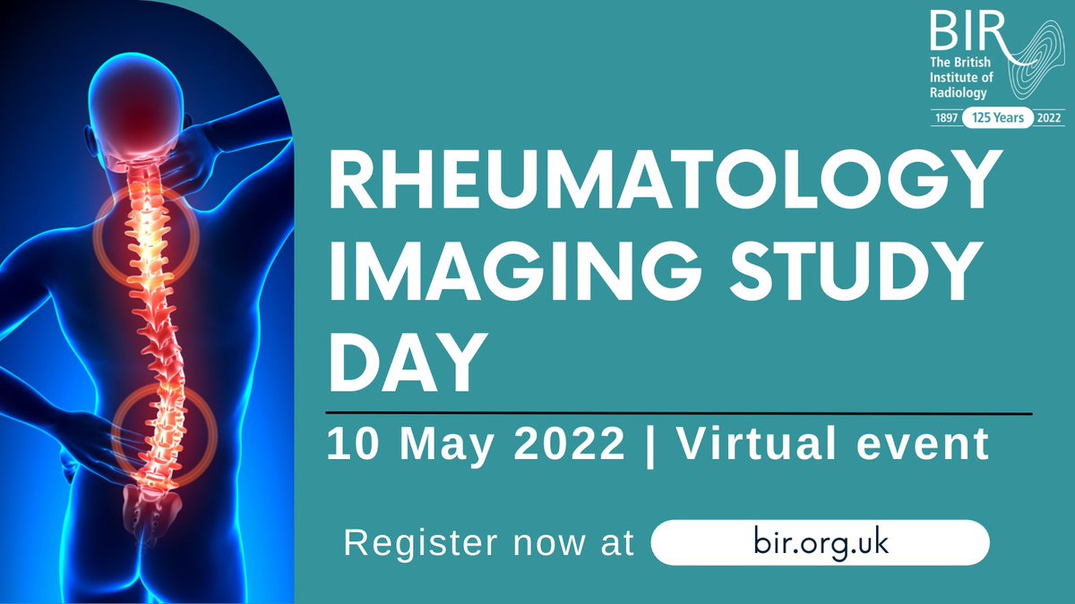 BIR (@bir_news) on Twitter photo Only one more day to get signed up for the 'Rheumatology imaging study day' taking place tomorrow, 10 May. It will cover common rheumatological imaging challenges faced by the specialist and non-specialist reporting radiologist. bit.ly/Rheum22 <a href="/RCRadiologists/">The Royal College of Radiologists</a> <a href="/ESSRmsk/">European Society of Musculoskeletal Radiology</a> Only one more day to get signed up for the 'Rheumatology imaging study day' taking place tomorrow, 10 May. It will cover common rheumatological imaging challenges faced by the specialist and non-specialist reporting radiologist. bit.ly/Rheum22 <a href="/RCRadiologists/">The Royal College of Radiologists</a> <a href="/ESSRmsk/">European Society of Musculoskeletal Radiology</a>