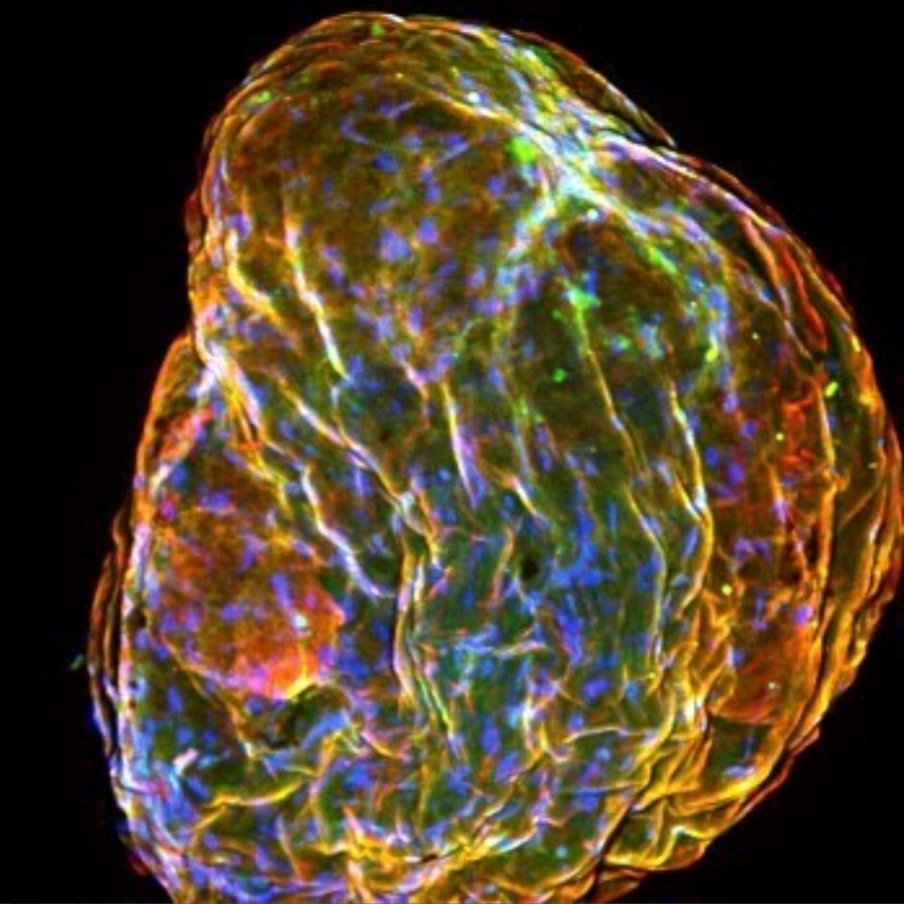 Our postdoc Lisa Fellner uploaded this picture of her beautiful iPSC-derived vessel organoid to <a href="/STEMCELLTech/">STEMCELL Technologies</a>'s #StemCellfie Contest. Check it out and vote for it here:
Stemcell.com/stemcellfie