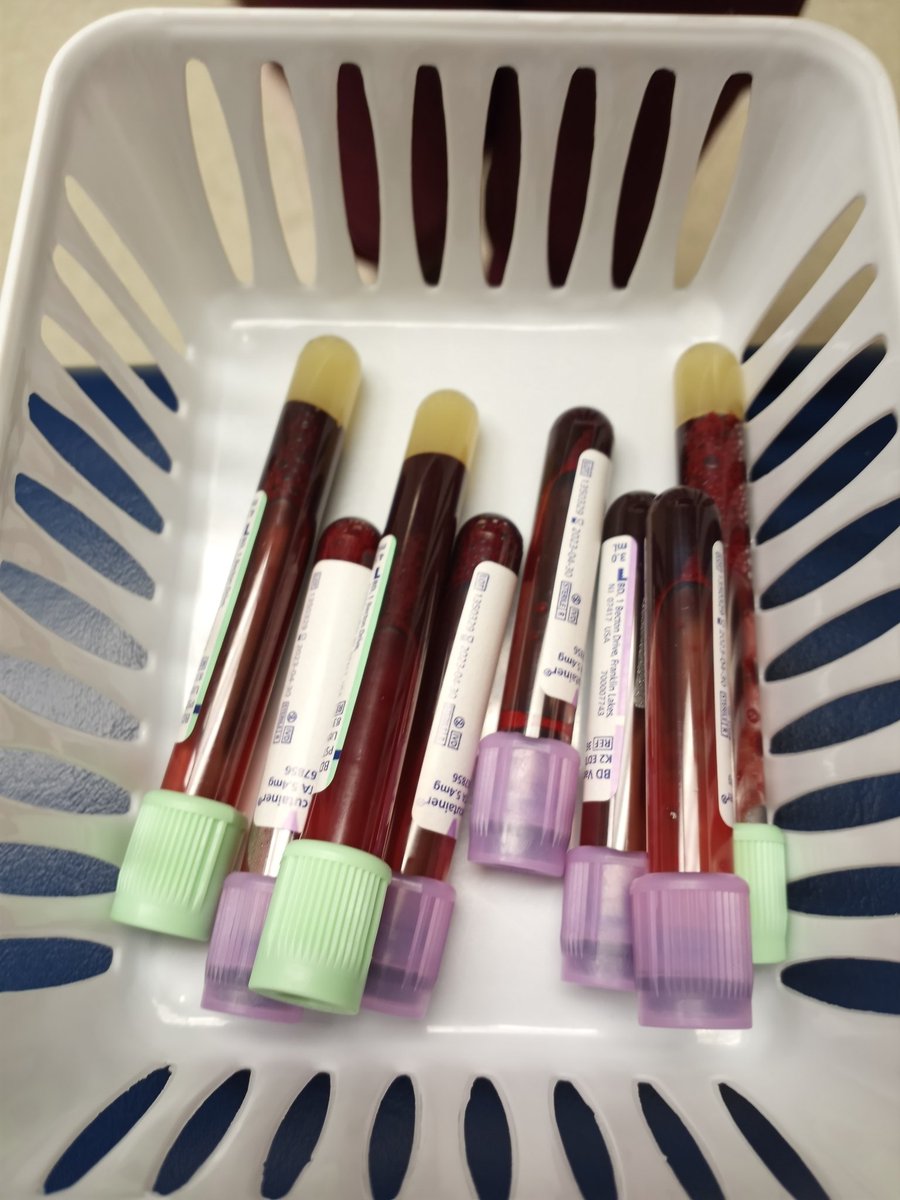 PumpAdrenaline's tweet photo. Bloodwork this morning.  Feel good hope all the levels come back where they want them.
#transplant #hospital https://t.co/pmzAKEJ1Eh