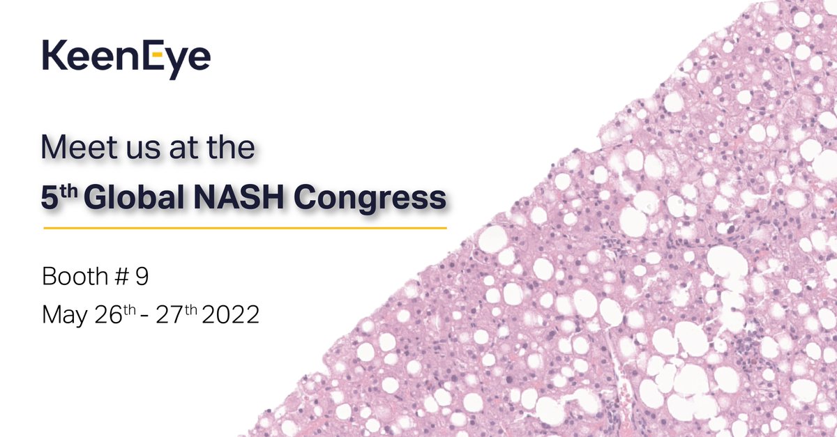 Keen Eye tweet media