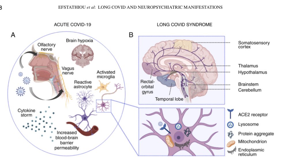 sandralopezleon's tweet photo. 🦠 Los síntomas #Neuropsiquiatricos son los más comunes en personas con #LongCOVID
➡️Depresión
➡️Ansiedad
➡️Neblina mental
➡️Problemas del sueño
➡️Fatiga crónica
➡️Problemas cognitivos
https://t.co/LkFMlqme3k
https://t.co/2SlX3WQbEV https://t.co/t7uVHX79KL