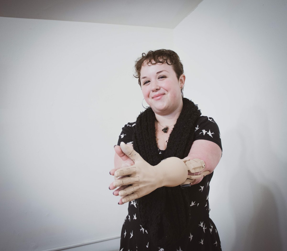 utgiorg's tweet photo. Ally is the recipient of a TrueLimb #bionicarm funded through Unlimited Tomorrow Global Initiative. We believe that everyone living with limb loss or limb difference should have access to advanced prosthetic technology. 

#prostheticarm #bionicarm #prostheticarmfunding https://t.co/E1zUnosbsM