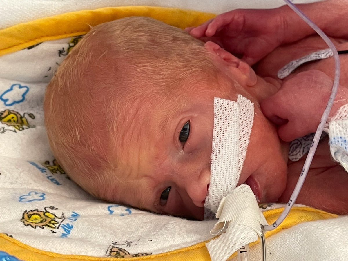 Honorary #SuperPanther Jack was born 4/21/22.. 13 weeks early and is already so loved and so strong! He can’t wait to meet his moms students 💜💛 #WeAreMaumee #CutestBabe #NICU <a href="/MHS_SP_Inc/">Super Panthers Inc.</a>