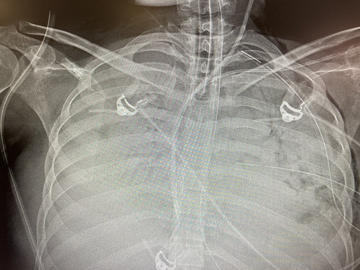 27 años también 👀. #medicina #radiologia #neumología