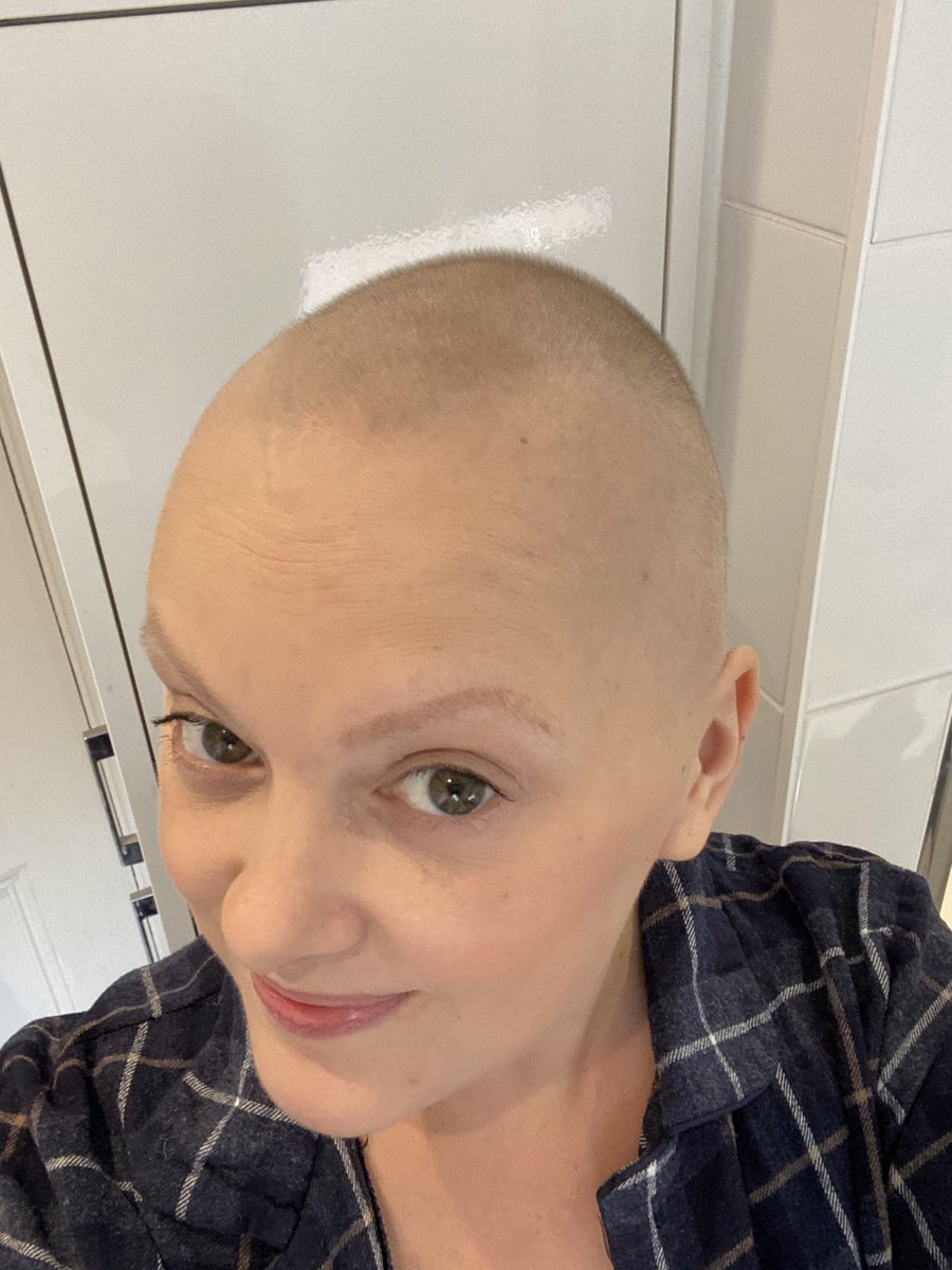 rachaelnolegs's tweet photo. Check it out! Actual visible hair growth! 😁😁 it seems to only be on the top and back at the moment, so a mullet essentially. I’ll take it though! ❤️ https://t.co/dftwKCXv3y