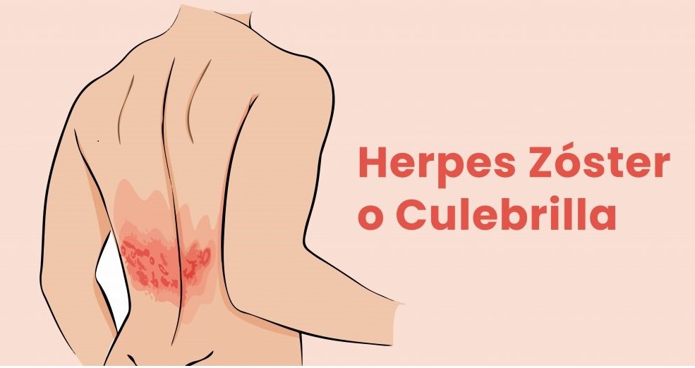 La Comunidad de Madrid comienza la vacunación contra el Herpes Zoster (culebrilla) de forma sistemática a las personas de 65 años de edad (nacidos en 1957)  y a las personas de 80 años de edad (nacidos en 1942).

csgandhi.es/vacuna-frente-…