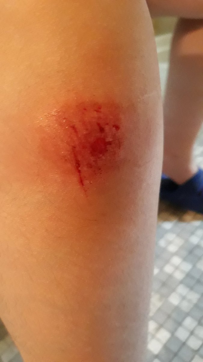 Annomynous tweet media