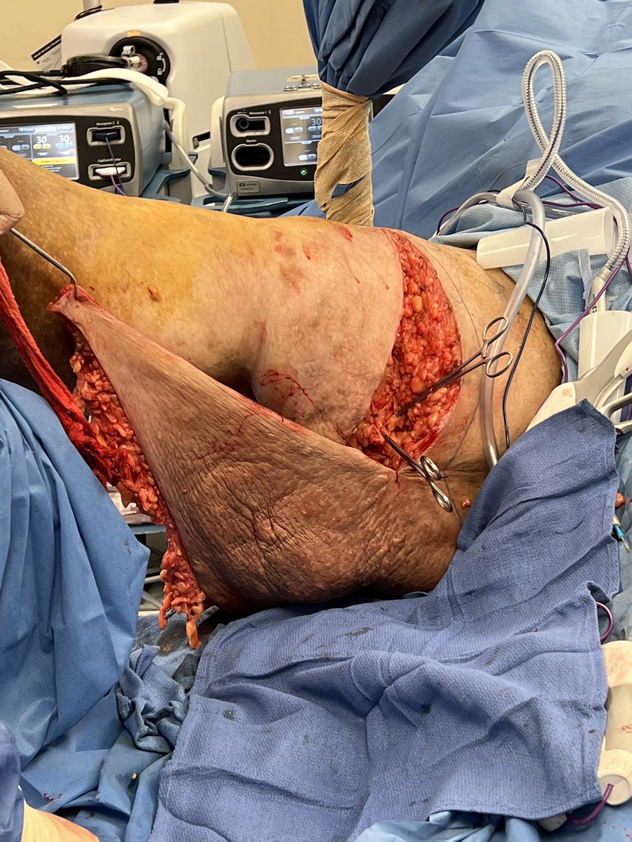 Kuldeep Singh MD tweet media