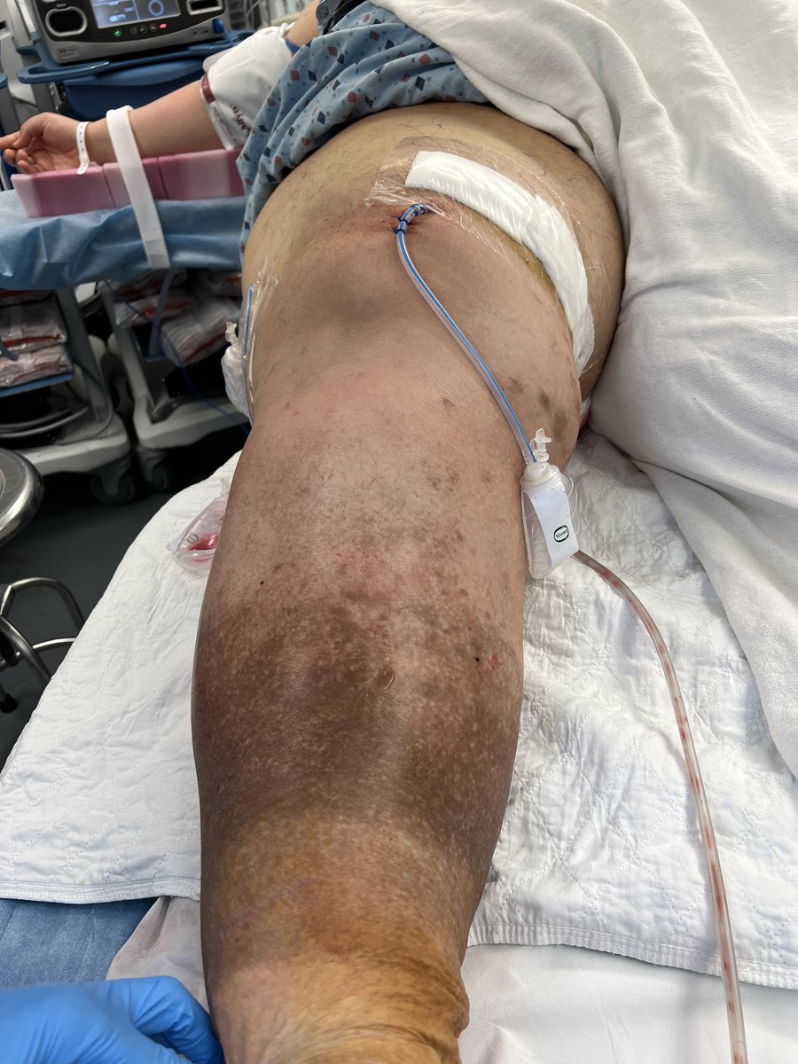 Kuldeep Singh MD tweet media