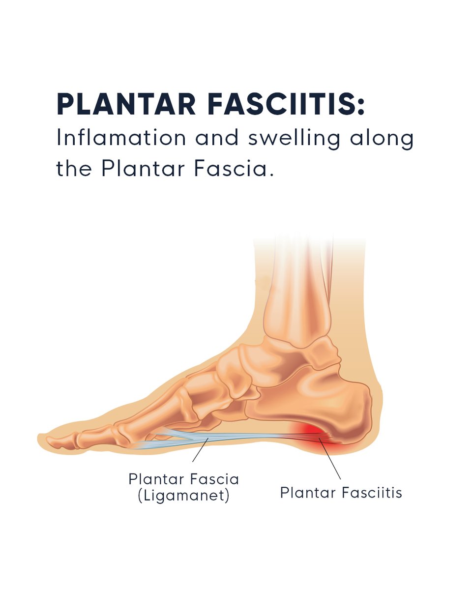 Copper Compression tweet media
