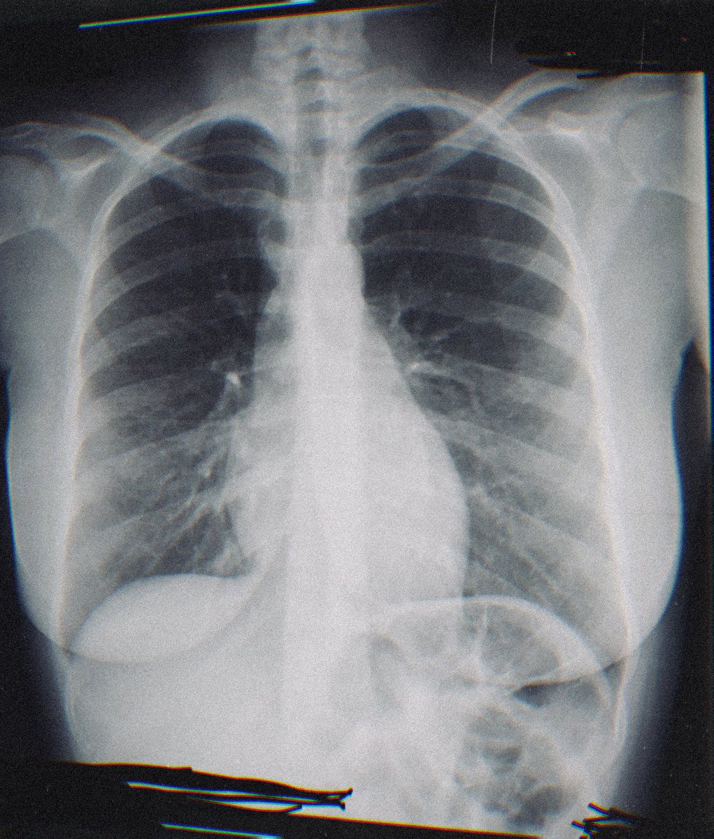 bellalikesfrogs's tweet photo. Had to go to A&amp;E today, I’m home awaiting emergency referral to a more local hospital for more tests, in the mean time here are my insides. 

Having to rest up because of drowsy pain meds, more funky animals to come soon I promise ❤️‍🩹 https://t.co/obZTnxEtRj