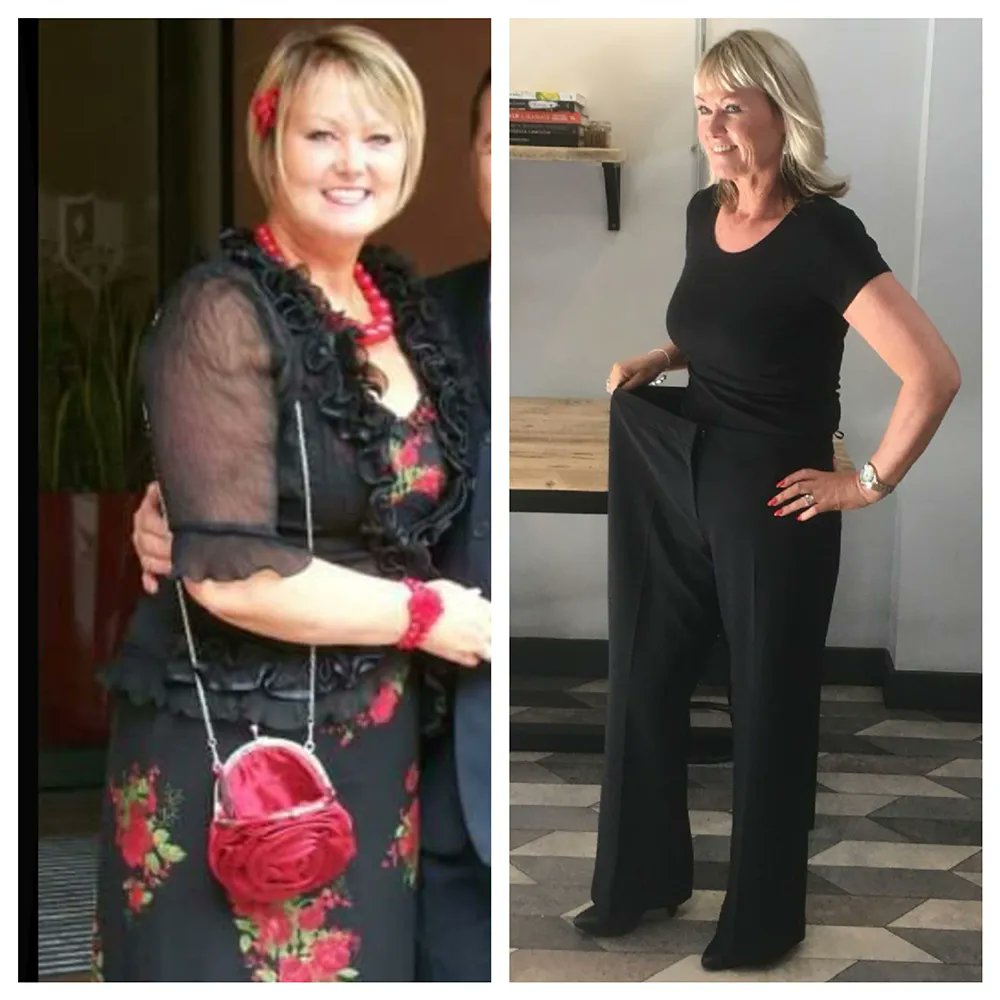 Daisy_KetoWoman's tweet photo. Quite a turnaround from Debra. Find out how she reversed her type 2 diabetes and lost a load of weight to boot in this week’s episode. Great job Debra. 💪❤️
#KetoWoman #KetoWomanPodcast #TransformationTuesdays https://t.co/XAQTfSMNEW