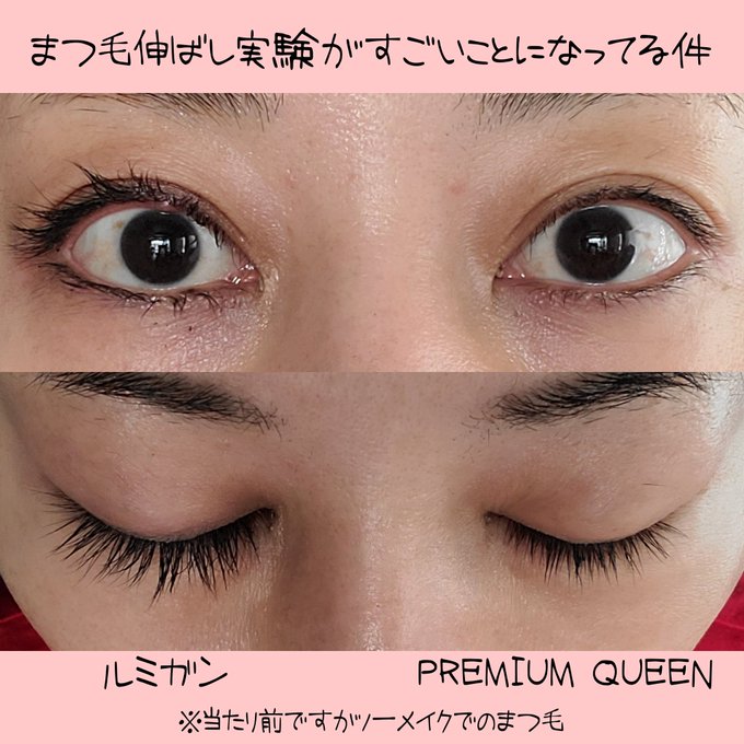 ルミガンの効果は 実際の使用者の口コミや副作用についても紹介 健康コラム