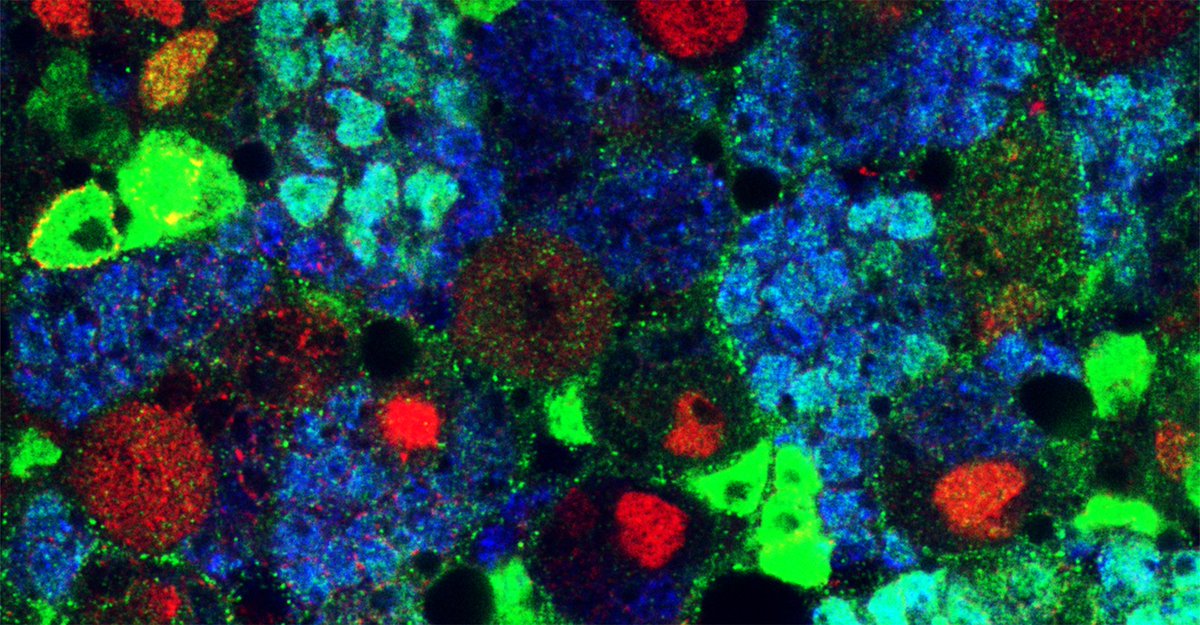 SOMM_alliance's tweet photo. Descubierto un nuevo regulador de la proliferación celular en el sistema nervioso, un hallazgo liderado por Investigadoras 👩‍🔬👩‍🔬 del Instituto de Neurociencias @NeuroAlc @UniversidadMH @csic https://t.co/tbutI4LQkY https://t.co/1tir0nSiI0