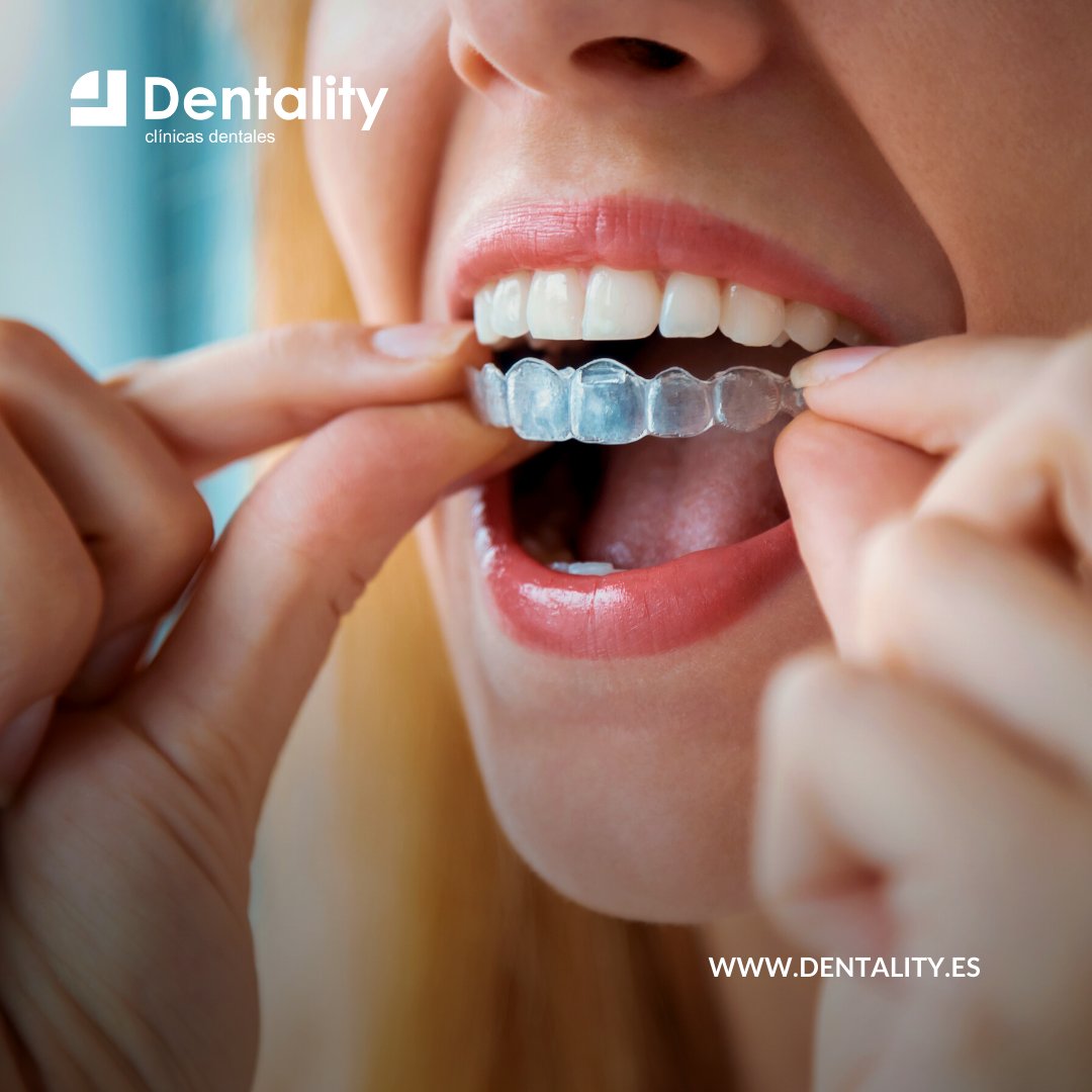 💜  Una de las cosas que hemos aprendido con la pandemia es a valorar más las sonrisas... Pon tus dientes a raya con la ortodoncia invisible. 

👉🏻dentality.es

📞 Talavera 925684900
📞 Plasencia 927700938
📞 Jaraíz de la Vera 927460808