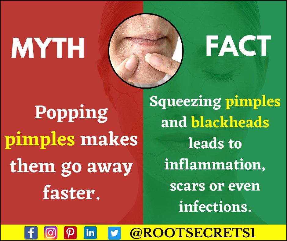 Rootsecrets1's tweet photo. MYTH Vs FACT : PIMPLES
Read Post and share with your friends.
Like & Follow our page for more health related information's. @rootsecrets1
.
.
.
.
#health #healthylife #rootsecrets #healthyfood #myth #fact #skincare #skin #pimples #blackheads #treating #inflammation #moisture https://t.co/Kj010yL3Ax
