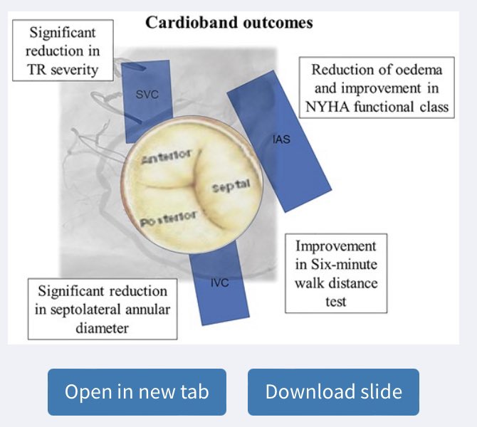 denisamuraru's tweet photo. Outcomes after TV annuloplasty w/ #Cardioband showing sustained TR reduction, improved functional class and symptoms at 1 year #EHJCVI 

https://t.co/iWzM5I0uTb

@ESC_Journals @GeraldMaurer @EACVIPresident @DonalErwan @VDelgadoGarcia @hahn_rt @PhilippLurz @FabienPraz https://t.co/ZCNFoIKi43