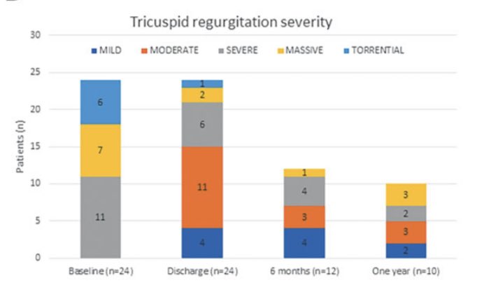 denisamuraru's tweet photo. Outcomes after TV annuloplasty w/ #Cardioband showing sustained TR reduction, improved functional class and symptoms at 1 year #EHJCVI 

https://t.co/iWzM5I0uTb

@ESC_Journals @GeraldMaurer @EACVIPresident @DonalErwan @VDelgadoGarcia @hahn_rt @PhilippLurz @FabienPraz https://t.co/ZCNFoIKi43