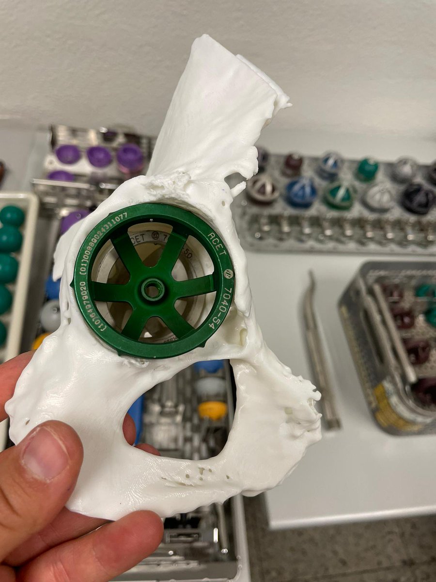 FabLab 3D Hospital Marañón tweet media